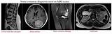 Pictures of Mri Scan What Can It Detect