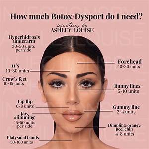 Lip Queen On Instagram Botox And Dysport Aren T Just For Wrinkles