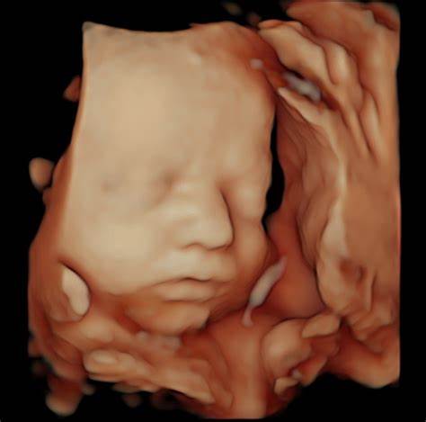 4d baby scan redditch