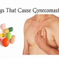 Drugs That Cause Gynecomastia