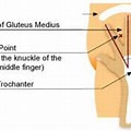 Ventrogluteal Injection Site Diagram
