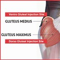 Ventrogluteal Injection Technique
