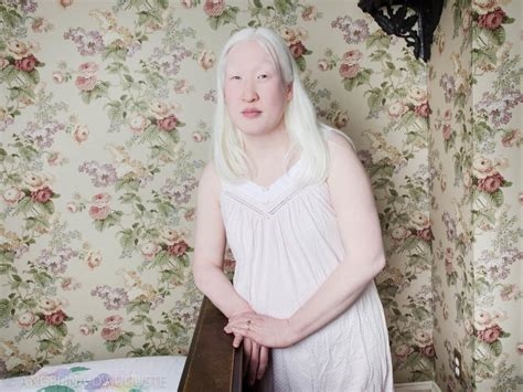albino rj nude nude