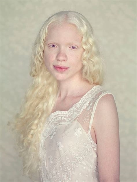 albinos nude nude