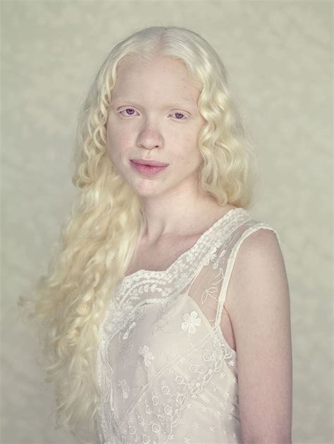 albinos nude nude