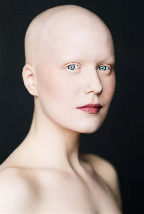 bald women xxx nude