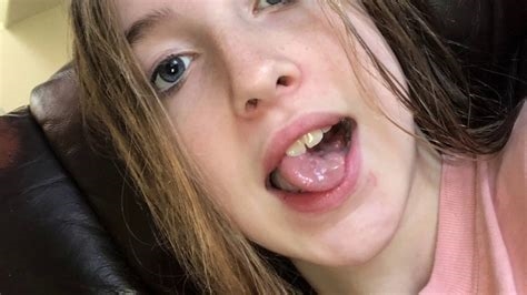blow job with braces nude