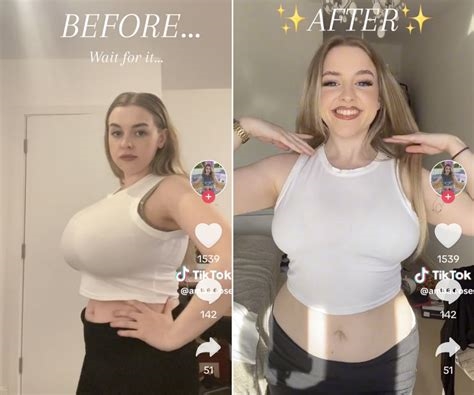 breast reduction before and after tiktok nude
