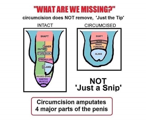 circumcisionfetish nude