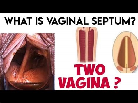 double vaginal nude