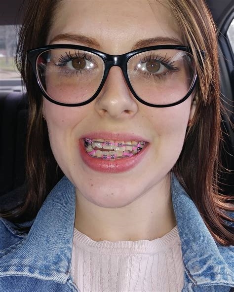 glasses and braces porn nude