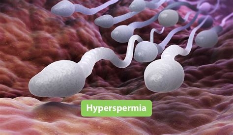hyperspermia video nude