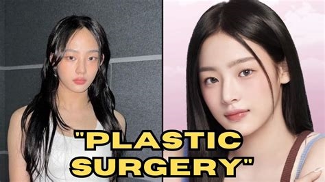 newjeans plastic surgery reddit nude