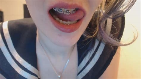 onlyfans with braces nude