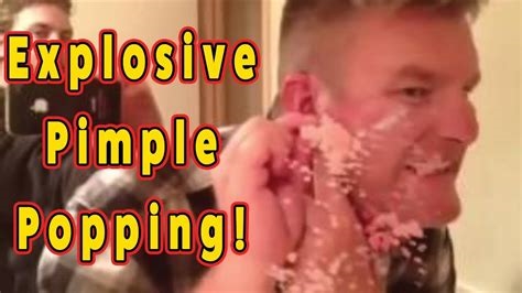 pimple popping fetish nude