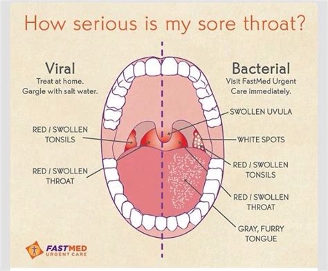 sore throat porn nude
