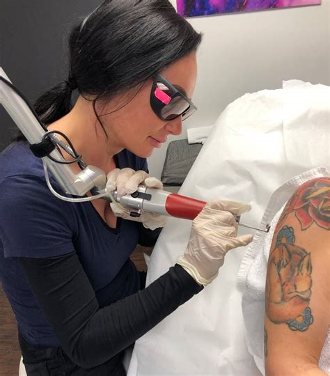tattoo removal porn nude