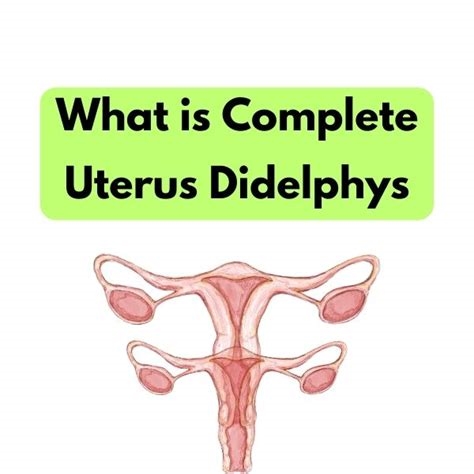 uterus didelphys evelyn nude