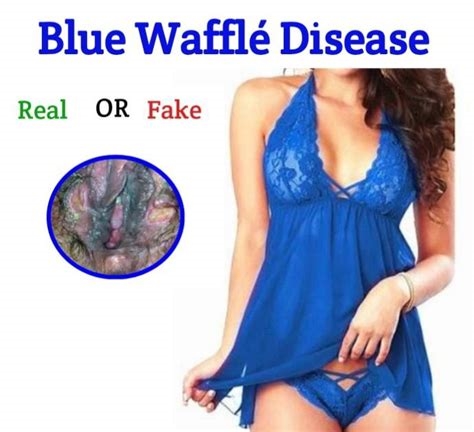 what is blue waffle reddit nude