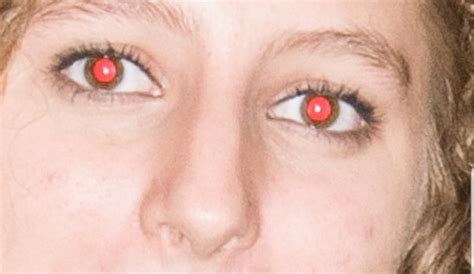 why are claudia's eyes red nude