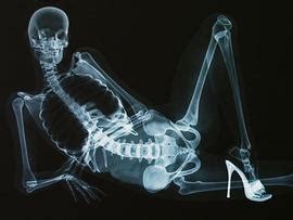 x ray pron nude