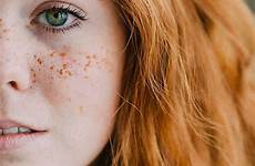 ginger eyes girl green freckles hair scottish red close haired blue redhead girls beautiful stocksy visit hairstyles