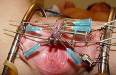 clit torture clitoris pain piercing pierced pussymodsgalore needles galore tumbex