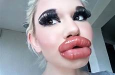 lips lip wants pout 20th bigger ivanova fette lippen injections