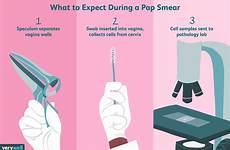 pap smear cervical cancer examination speculum vaginal cervix expect tested detection stirrups microscope collected shown