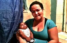 microcephaly npr infants surge brazil vitoria defect abnormally