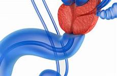 prostate massage therapy definition