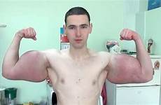 synthol biceps arms freak russian guy injections bodybuilding body skinny building contest