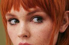 freckles redheads pecas pelirroja myteenwebcam maio joy having