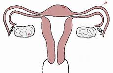 gif uterus female endometriosis outside