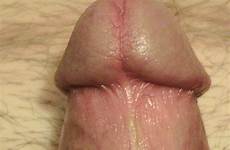 penis head cock circumcised closeup