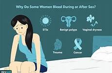 bleeding causes verywell seong joshua infections sexually