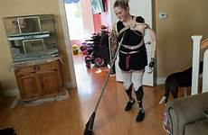 amputee quadruple kaitlyn dobrow chores prosthetic limbs prosthetics huntington scng prostheses venegas ana prosthesis toward independence ocregister
