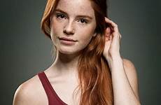 freckles redheads luca hollestelle store braces akiva