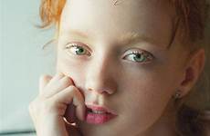 ginger redheads freckles