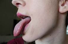 alban ashley tongue