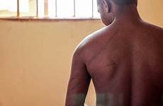 beaten endured allegedly ugandans lawsuit lgbtq imprisoned scarred uganda alleged mccool