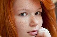 mia sollis freckles redheads skin pasty casper skinned ghost ginger revlt