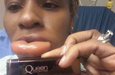 lips swollen after woman lipstick lip dubious gets using before