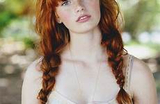 redheads freckles alea ginger rood frey