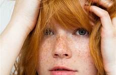 freckles redhead sommersprossen haare sollis mia redheads rote rotblonde rot pelirroja pecas rothaarige