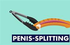 penis splitting