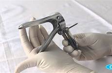 speculum vaginal cusco stainless