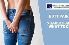 butt pain causes top buttock do should