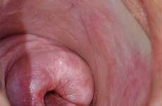 tumblr vagina fetish gyno tumbex hospital insertions
