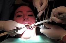 filling tooth dentists get office